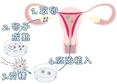 PGT实验室